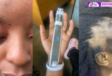 IMAGES OF SOCIALITE RUTH RONNIE BATTERED SURFACE ONLINE